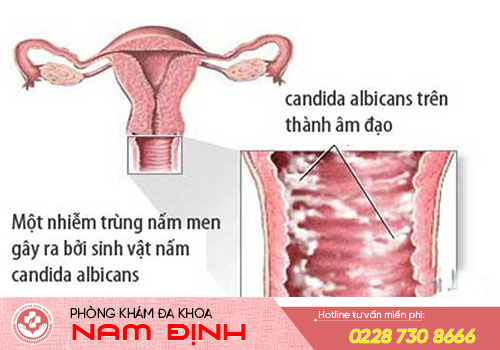 dịch âm đạo