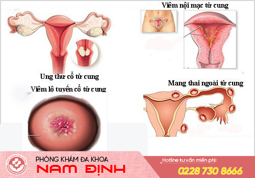 khí hư màu đen