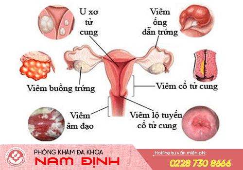 ngứa vùng kín