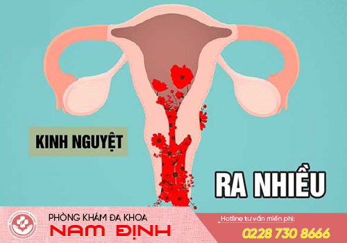 bệnh kinh nguyệt