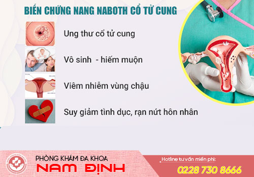 nang naboth cổ tử cung