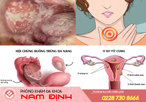 chậm kinh