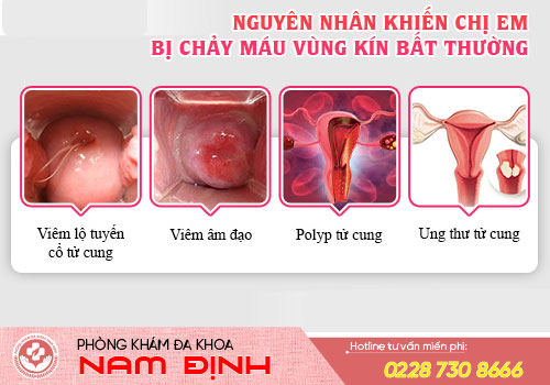 chảy máu vùng kín
