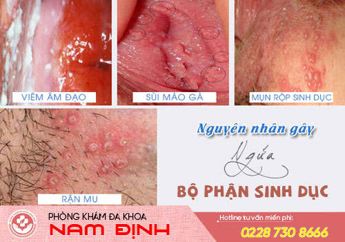 ngứa vùng kín