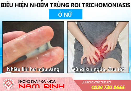 nhiễm trichomonas