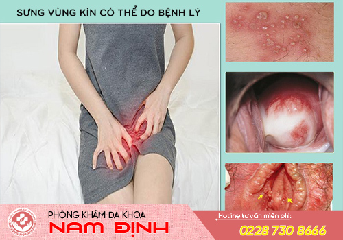 Sưng vùng kín là bệnh gì? Có nguy hiểm không?