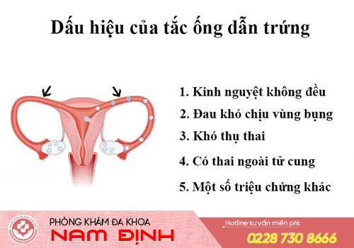 tác vòi trứng