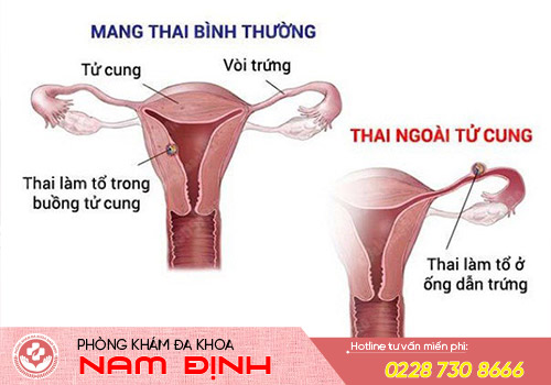 khí hư màu đỏ