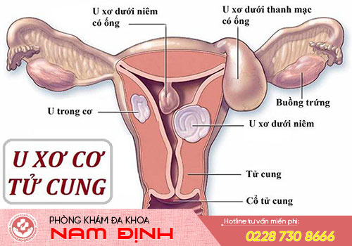 kinh nguyệt màu đen