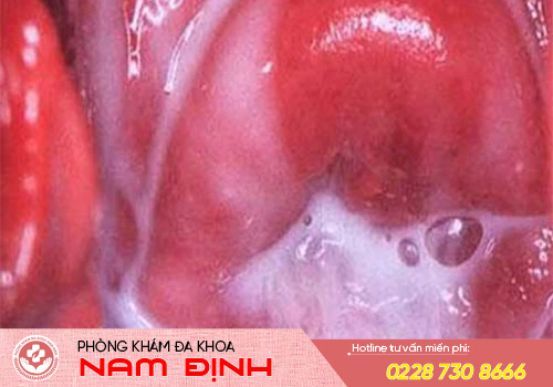 bệnh phụ khoa bệnh phụ khoa