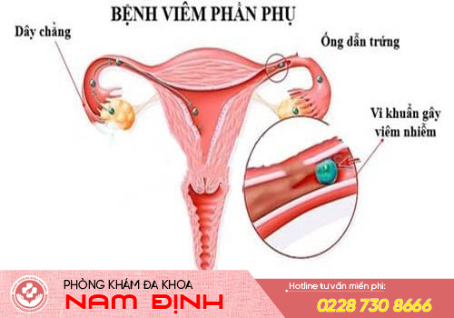 khí hư vón cục