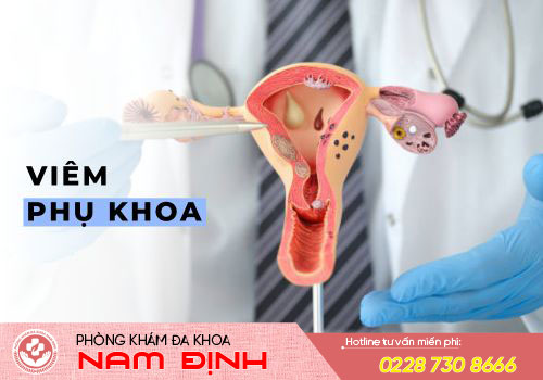 viêm phụ khoa