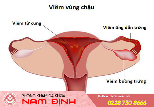 đau bụng dưới