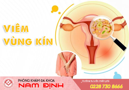 viêm phụ khoa