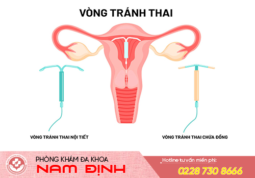 đặt vòng